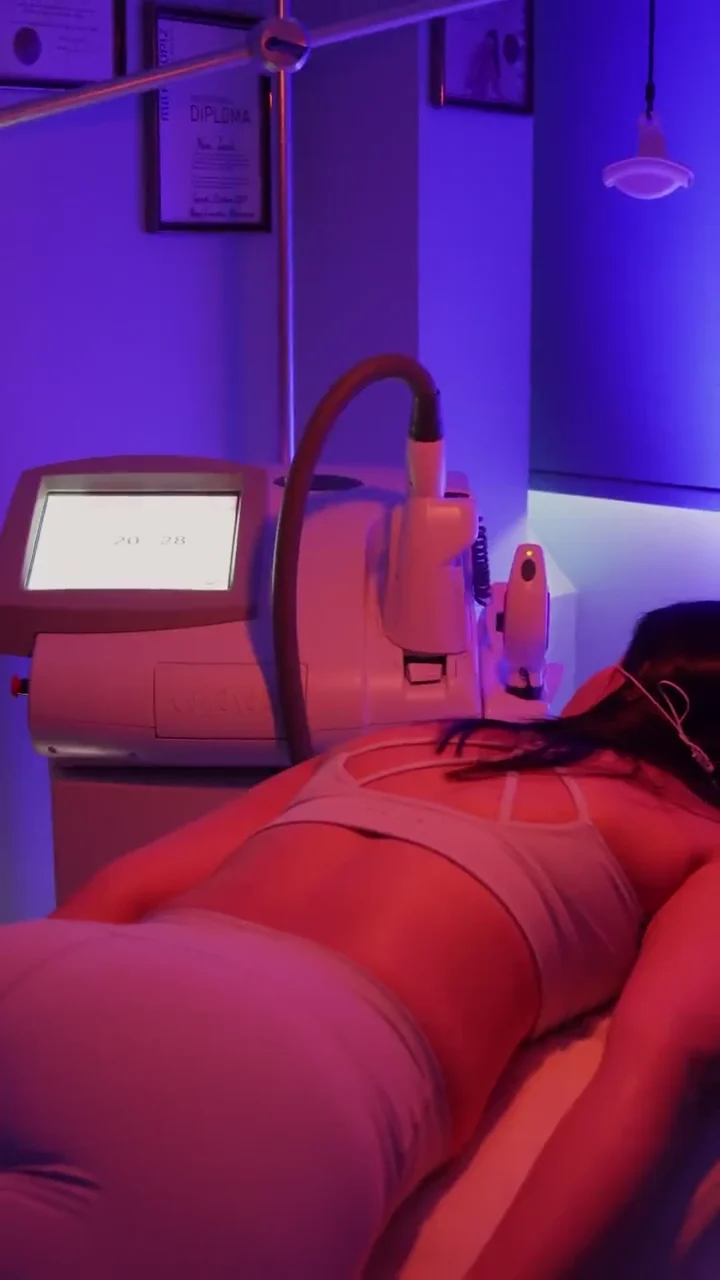 Client resting on the treatment bed during a body laser session