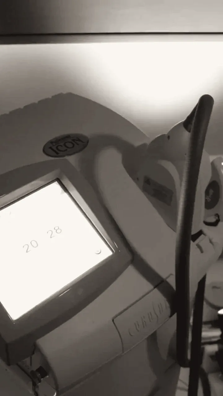 Laser platform used at the North York clinic